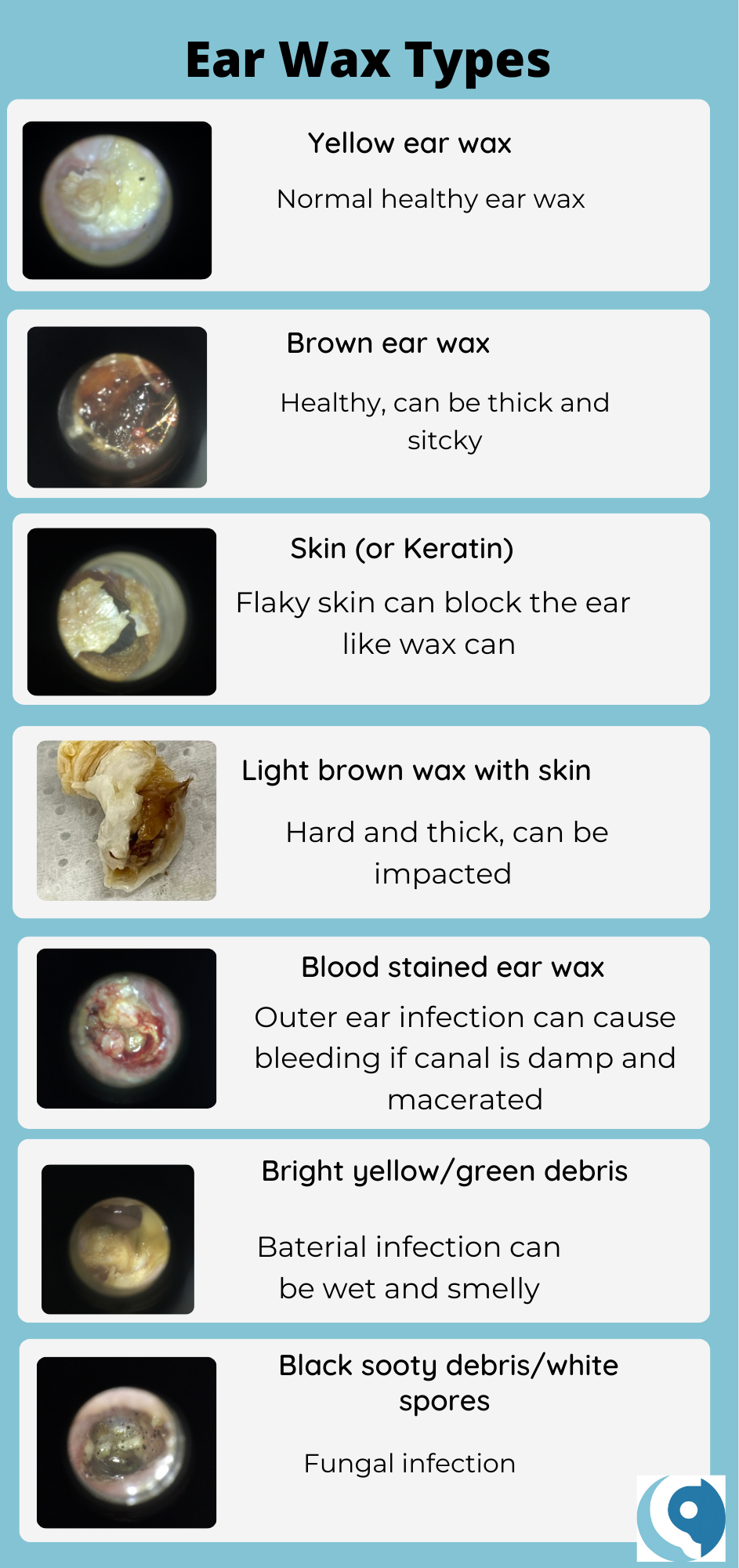 Ear Wax Types Crystal Clear Clinic
